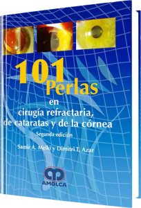 101 Perlas en Cirugía Refractaria de Catarátas y Cornea. 2da Edición
