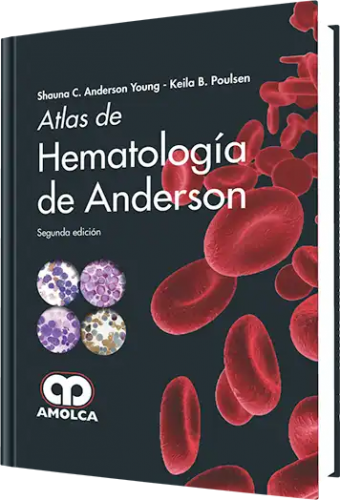Atlas de Hematología de Anderson. Segunda Edición