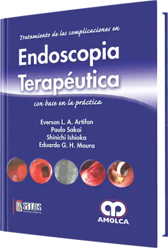Endoscopia Terapéutica