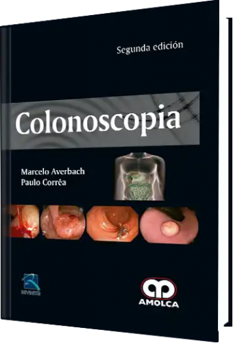 Colonoscopia. Segunda Edición 9789588950136
