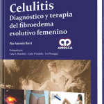 Celulitis Diagnóstico y Terapia del Fibroedema Evolutivo Femenino