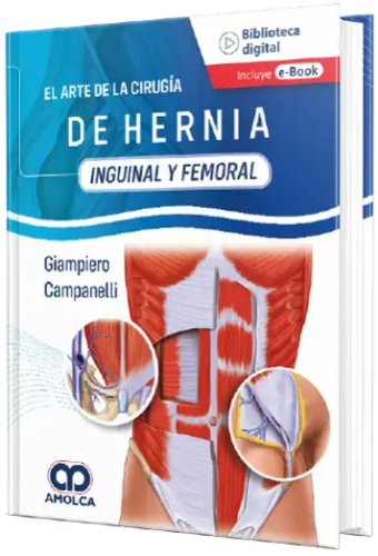 El Arte de Hernia Inguinal y Femoral