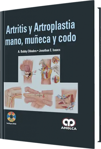 Artritis y Artrosplastia Mano, Muñeca y Codo