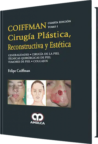 Cirugía Plástica Reconstructiva y Estética. 4ta. Edición Tomo I. Generalidades