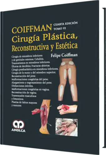 Cirugía Plástica Reconstructiva y Estética. 4ta. Edición Tomo VI. Cirugía de Miembros Inferiores y d