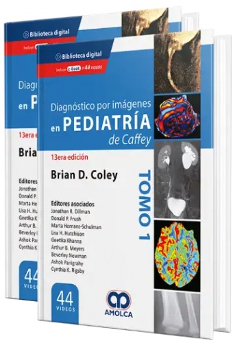 Diagnóstico por imágenes en Pediatría de Caffey, 13ª edición Tomos 1 y 2.