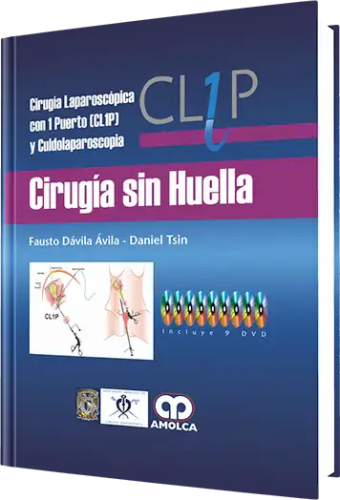 Cirugía Laparoscópica con 1 Puerto (Cl1p) y Culdolaparoscopía