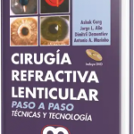 Cirugía Refractiva Lenticular.