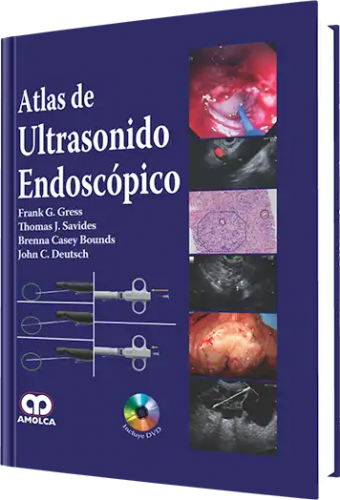 Atlas de Ultrasonido Endoscópico. Incluye DVD