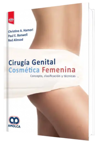 Cirugía Genital Cosmética Femenina. Concepto, Clasificación y Técnicas.  Incluye e-Book Gratuito