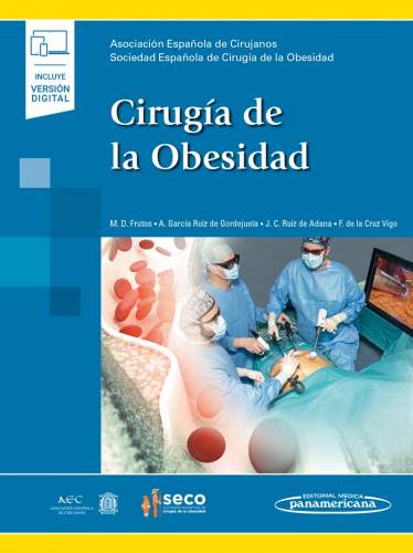 AEC-SECO: Cirugía de la Obesidad 9788491105176