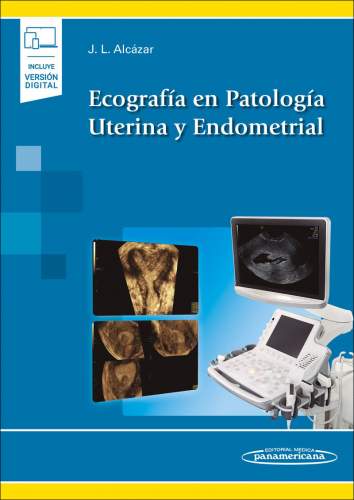 Alcazar: Ecografía en Patología Uterina y Endometrial 9788491106135