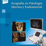 Alcazar: Ecografía en Patología Uterina y Endometrial 9788491106135