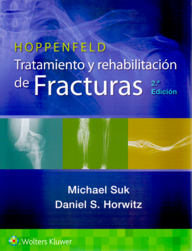 Hoppenfeld. Tratamiento y rehabilitación de fracturas 2 Ed. 9788418563898