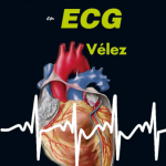 Vélez: Kit de Supervivencia en ECG 9788418068836