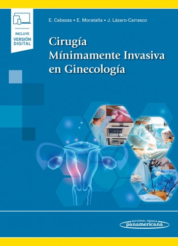 Cirugía Mínimamente Invasiva en Ginecología 9788491109532