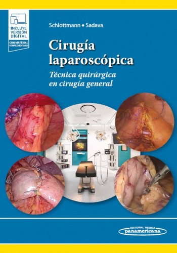 Cirugía laparoscópica Técnica quirúrgica en cirugía general 9789500697071