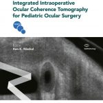 Integrated Intraoperative Ocular Coherence Tomography for Pediatric Ocular Surgery