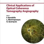 Clinical Applications of Optical Coherence Tomography Angiography