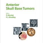 Anterior Skull Base Tumors