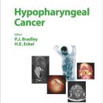Hypopharyngeal Cancer