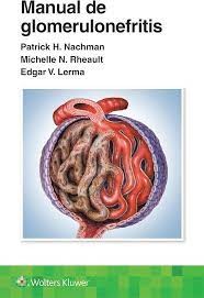 Manual de glomerulonefritis 9788419663160