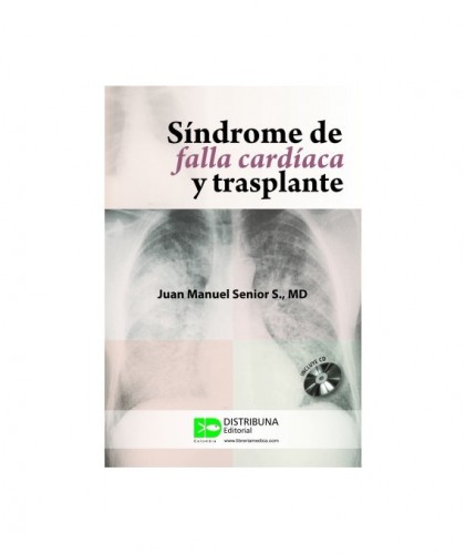 Síndrome de falla cardíaca y trasplante 9789588379289
