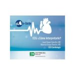 ECG: ¿Cómo interpretarlo?
