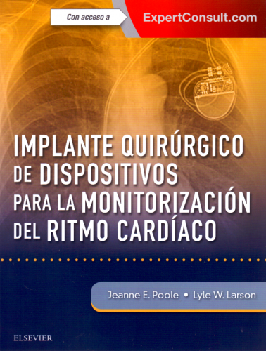Poole: Implante quirúrgico de dispositivos para la monitorización del ritmo cardíaco + ExpertConsult 9788491133148