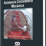 Asistencia Circulatoria Mecánica. Principios y Aplicaciones