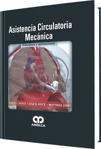 Asistencia Circulatoria Mecánica. Principios y Aplicaciones