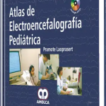 Atlas de Video Electroencefalografía Pediátrica