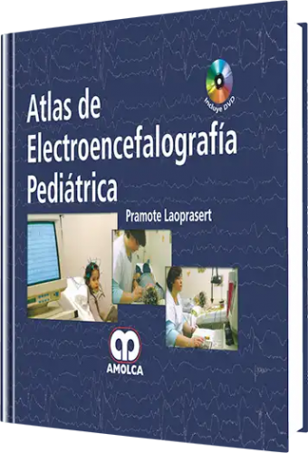 Atlas de Video Electroencefalografía Pediátrica