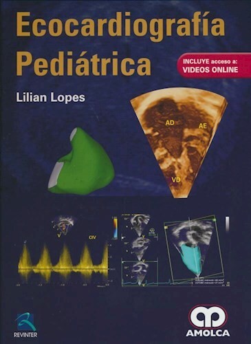 Ecocardiografía Pediátrica