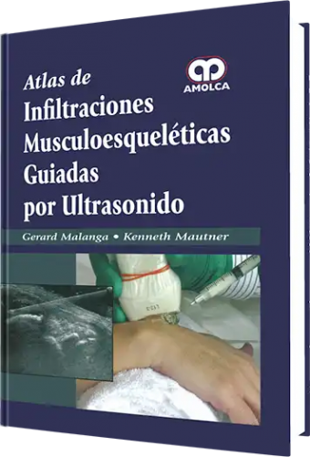 Atlas de Infiltraciones Muscoloesqueléticas Guiadas por Ultrasonido