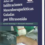 Atlas de Infiltraciones Muscoloesqueléticas Guiadas por Ultrasonido