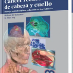 Cáncer Recurente de Cabeza y Cuello