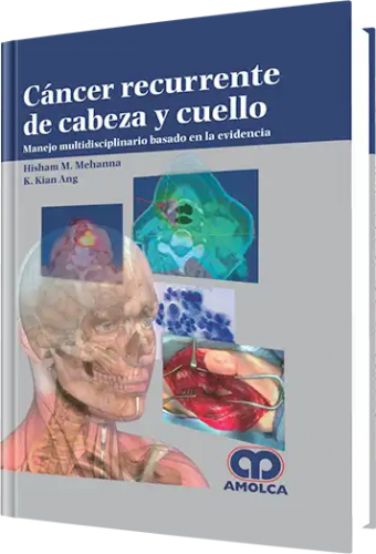 Cáncer Recurente de Cabeza y Cuello