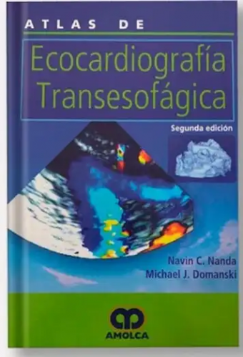 Ecocardiografía Transesofágica