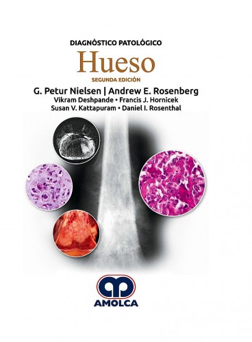 Diagnóstico Patológico:  Hueso. 2da edición