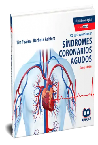 ECG de 12 derivaciones en síndromes coronarios agudos 4ª edición. Incluye E-book Gratuito