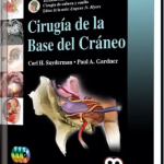 Cirugía de Cabeza y Cuello. Cirugía de la Base del Cráneo