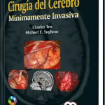 Cirugía del Cerebro Mínimamente Invasiva