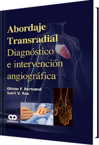 Abordaje Transradial  Diagnóstico e Intervención Angiográfica