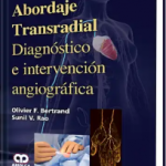 Abordaje Transradial  Diagnóstico e Intervención Angiográfica