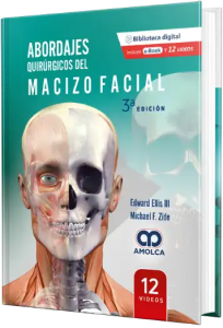 Abordajes Quirúrgicos del Macizo Facial  3a EDICIÓN.