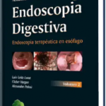 Actualización en Endoscopia Digestiva.  Volumen II. SOBED