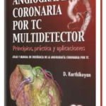Angiografía Coronaria por TC Multidetector. Principios, Práctica y Aplicaciones