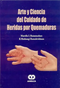 Arte y Ciencia del Cuidado de Heridas por Quemaduras