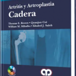 Artritis y Artroplastia Cadera. Incluye DVD